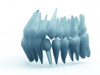 Read more about the article Implanty 3D w służbie medycznej