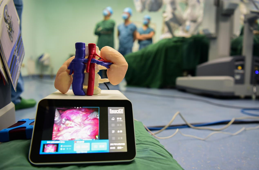 Implant z PEEK-u lewej żyły nerkowej w zespole dziadka do orzechów