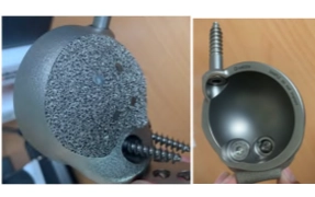 Wydruk z drukarki TruPrint 3000 przykład 1