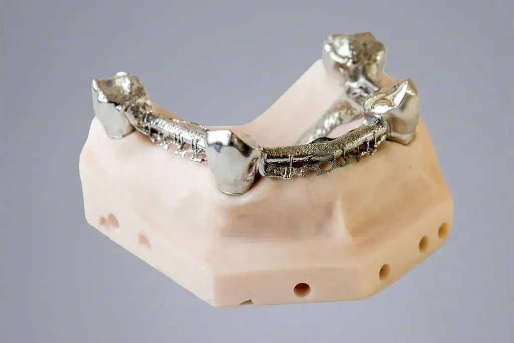 most stomatologiczny stworzony w technologii hybrydowej - druk i frez cnc